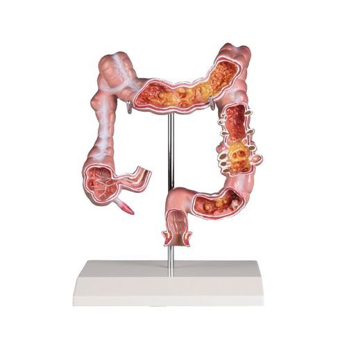 Anatomisches Kolonmodell - K285 - Erler-Zimmer - für die Ausbildung