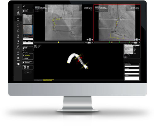 Analysesoftware - CAAS WORKSTATION - Esaote - Visualisierung / Angiographie