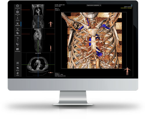 3D-Visualisierung-Software - 3MENSIO - Esaote - Analyse / medizinisch / Computertomographie