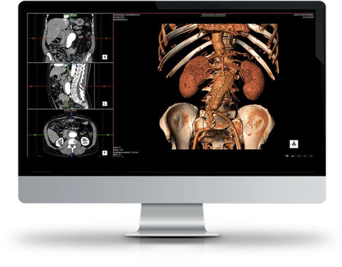 Visualisierungssoftware - SUITESTENSA RIS PACS - Esaote - Diagnose / für medizinische Bildgebung / medizinisch