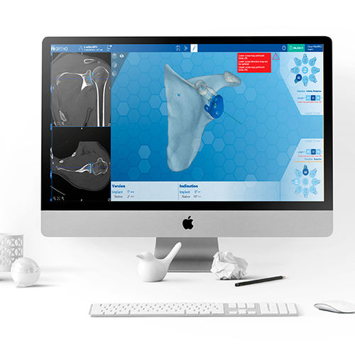 Schulterchirurgie-Software - e-Ortho - FH Orthopedics - Anatomie / Computertomographie / präoperativ