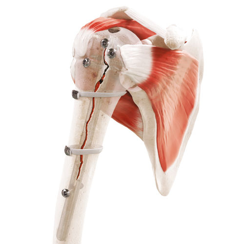 Cerclagekabel für periprothetische Fraktur - Strapflex - FH Orthopedics - Multifilament-Polymer
