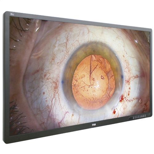 Medizinisch Monitor - FM-A5505DGC - FSN Medical Technologies - für Endoskopie / OP / Full HD
