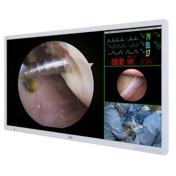 Monitor für OP-Bereich - FM-A5504DS - FSN Medical Technologies - 4K / 55" / LCD