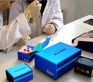 Multifunktions-Reagenz - Nephstar  - Goldsite Diagnostics Inc. - Protein / IgA / IgG