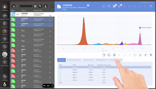 Analysesoftware - Platinum 6 - Helena Biosciences Europe  - für Patientendatenverwaltung / Steuerung / Reporting