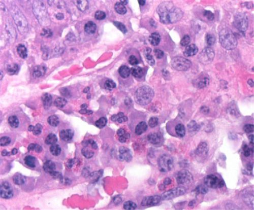Farbstoff Reagenz - 01HEMH1000 - Histo-Line Laboratories - für die Histologie