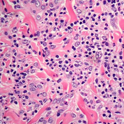 Farbstoff Reagenz - Eosin Y 1% alcoholic solutions - Histo-Line Laboratories - für die Histologie / flüssig