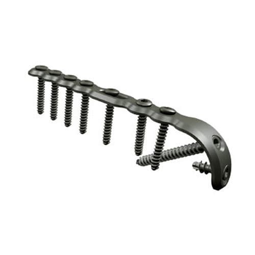 Kompressionsplatte für Olekranon - OL - I.T.S.   - mit Verriegelung / Metall