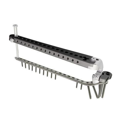 Kompressionsplatte für Tibia - PTL - I.T.S.   - proximal / seitlich / mit Verriegelung