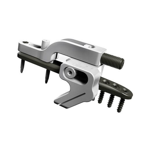 Osteotomieplatte für Ulna - UOL 2 - I.T.S.   - distal / mit Verriegelung / Metall