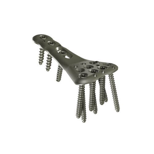 Kompressionsplatte für Radius - PRL2 - I.T.S.   - distal / mit Verriegelung / Metall