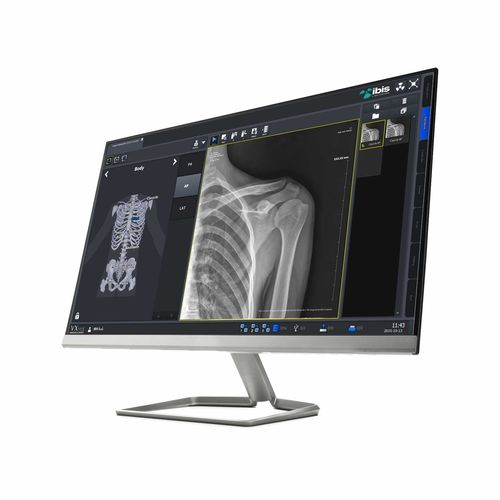 Röntgensoftware - IBIS X Ray Systems - Viewer / für Tablet-PC