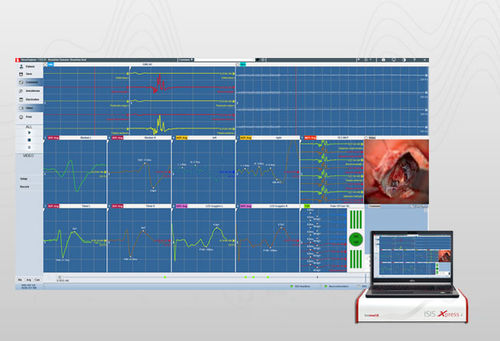 Steuerungssoftware - NEX2019 - inomed Medizintechnik - Monitoring / Mess / Sicherheit