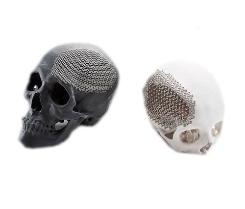 Patientenspezifisches Schädelimplantat - JCI - Jeil Medical Corporation