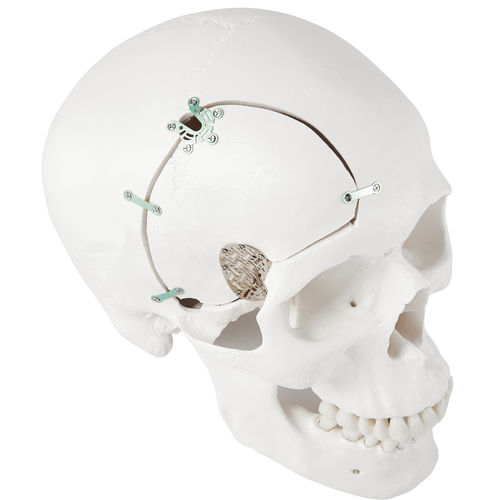 Nicht resorbierbares Schädelfixierungssystem - LeForte Neuro 0.3 - Jeil Medical Corporation