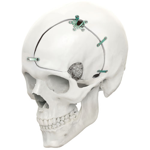Nicht resorbierbares Schädelfixierungssystem - LeForte Neuro 0.6 - Jeil Medical Corporation