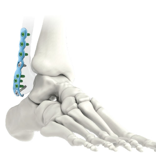 Kompressionsplatte für Fibula - ARIX 3.5 - Jeil Medical Corporation - distal / seitlich / mit Verriegelung