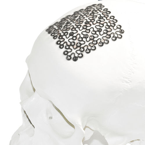 Schädelimplantat - Jeil Medical Corporation