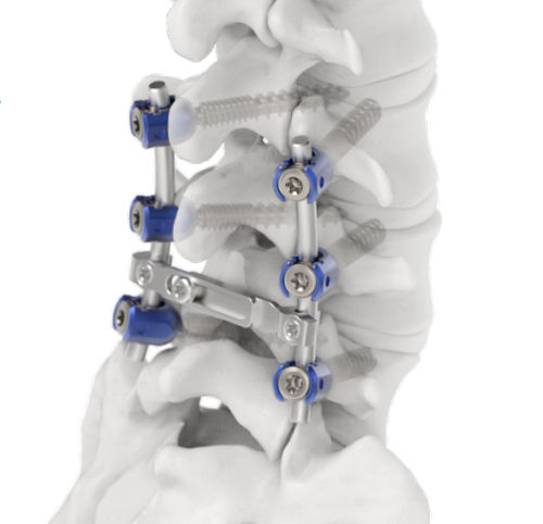 Stabilisierungssystem für Osteosynthese / LWS - Jeil Medical Corporation - dorsaler Zugang / für Erwachsene