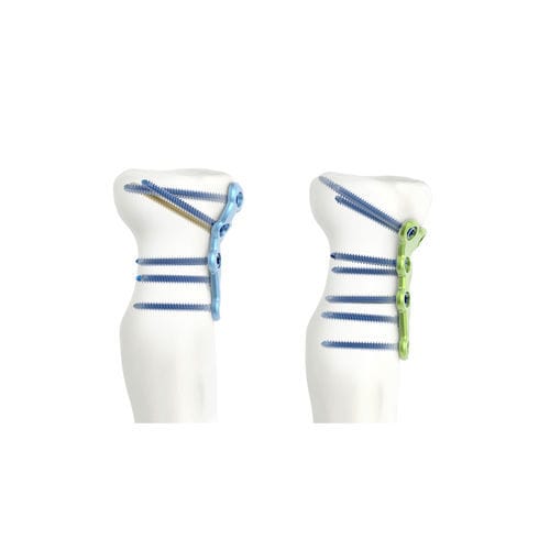 Kompressionsplatte für Radiuskopf - ARIX 2.0 - Jeil Medical Corporation - proximal / mit Verriegelung / Titan