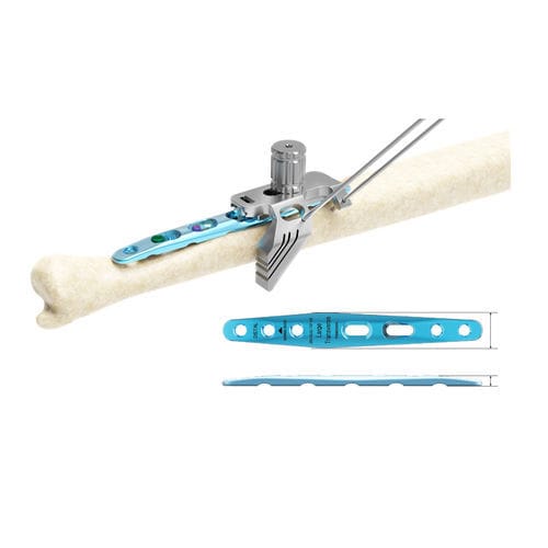 Osteotomieplatte für Ulna - ARIX 2.8 - Jeil Medical Corporation - medial / mit Verriegelung / Titan