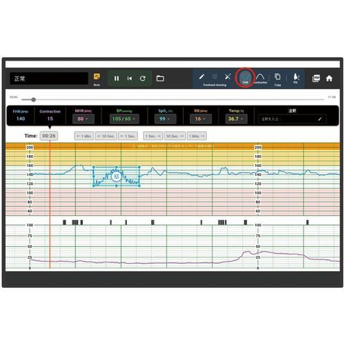Simulator für Fötalmonitoren - KKG-5 - Kyoto Kagaku  - mütterliche/neonatale Pflege / für Kardiotokographie / Monitoring
