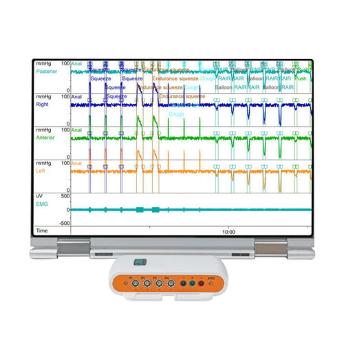 Tragbarer Patientenmonitor - Solar™ Go  - Laborie Medical Technologies - Manometrie / für Intensivpflege / für Erwachsene