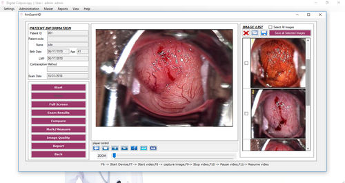 Datenverwaltungssoftware - 01047 series - Medgyn Products - Visualisierung / Mess / Erfassung