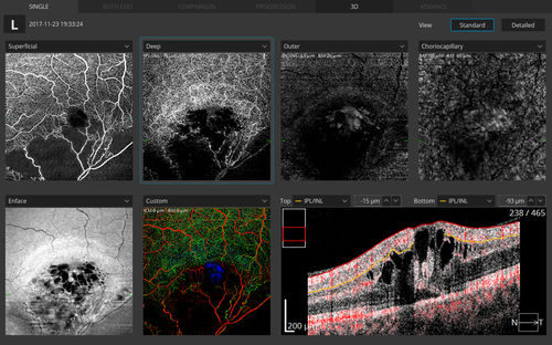 Software-Modul / Angiographie - Optopol Technology - für Ophthalmologie / Mess / Visualisierung