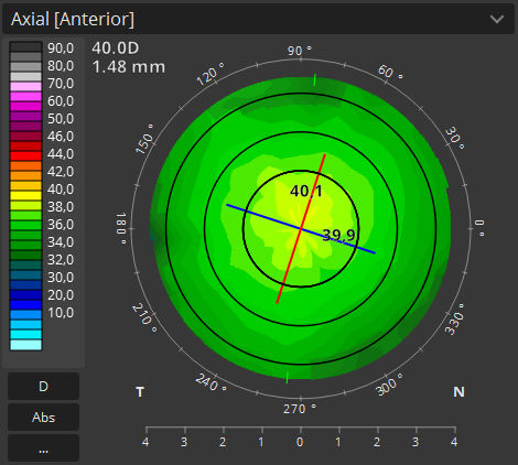Software-Modul / für Ophthalmologie - T-OCT™ - Optopol Technology - Analyse / Erfassung / Hornhaut