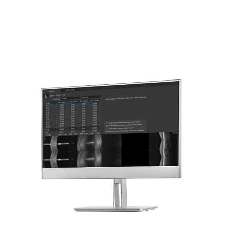 Software-Modul / für Ophthalmologie - B-OCT®  - Optopol Technology - Mess / Bewertung / Management