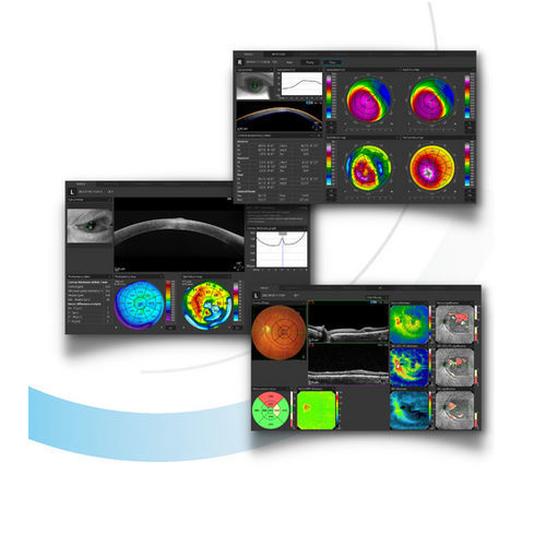 Software für Ophthalmologie - SOCT 11.5 - Optopol Technology - Analyse / Erfassung / Oculometrie