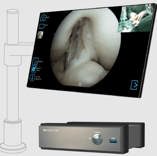 Chirurgischer Videorekorder - MVR 4K  - MediCapture - medizinisch / 4K / kompakt