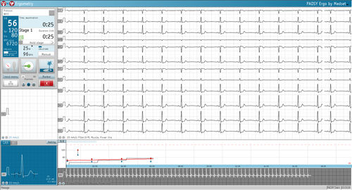 Analysesoftware - PADSY Ergo - Medset Medizintechnik  - Mess / für Spiroergometrie-System