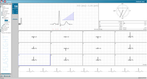 Software für EKG - Medset Medizintechnik  - Analyse / Mess