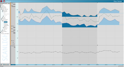 Software für Blutdruckmonitor - PADSY RR - Medset Medizintechnik  - Mess