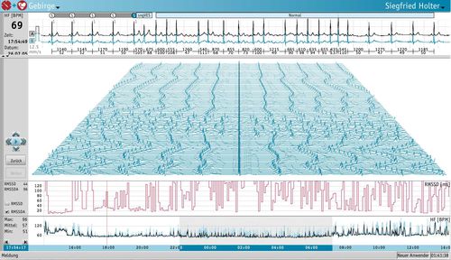 Analysesoftware - Medset Medizintechnik  - Monitoring / für Langzeit-EKG