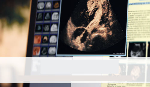 Reporting-Software - SonoWin&reg; - MESO - Archivierung / Datenverwaltung / für Patientendatenverwaltung