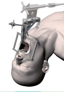Pharyngoskop für Erwachsene - Satou - Nagashima Medical Instruments - rechtwinklig