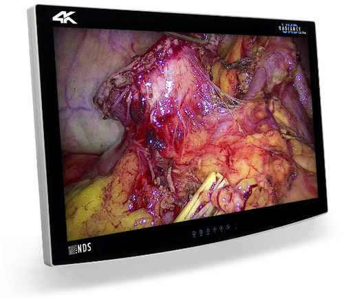 Medizinisch Monitor - RADIANCE® ULTRA - NDS Surgical Imaging - OP / 4K / 32"