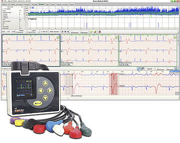 Analysesoftware - NH-301 - NORAV Medical - Diagnose / Monitoring / Aufzeichnung