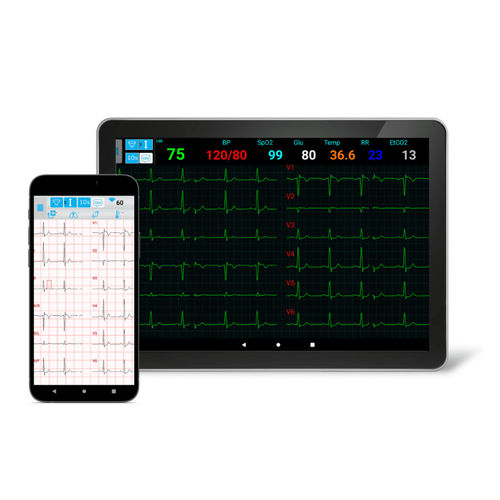 Web-Anwendung / Diagnose - NORAV Medical - Aufzeichnung / Streaming / medizinisch