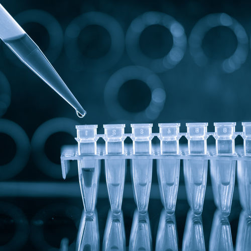 Testkit für Geschlechtskrankheiten - QP10705 - Randox Laboratories - Herpes-simplex-Virus / Treponema pallidum / Urin