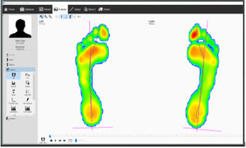 Podologie-Software - v9 Essentials - Materialise - Analyse / Mess / Content-Sharing