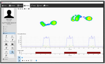 Podologie-Software - v9 Scientific - Materialise - für EMG / Analyse / Mess