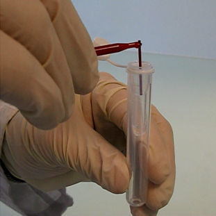 Reagenzkit / als Lösung - PN 2015 - Sebia  - Diagnose / für Diabetes / Labor