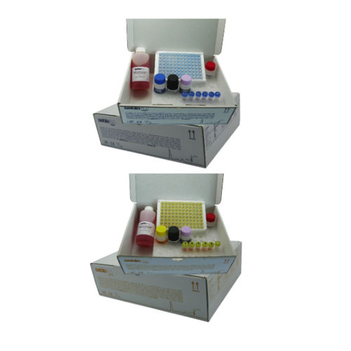Serum-Reagenzkit - FLC - Sebia  - für Kliniken / Labor / für Blutproben