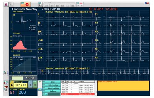 Software-Modul / Datenverwaltung - SEIVA Ergolog - Seiva - Aufzeichnung / Elektrokardiografie / für Belastungstest
