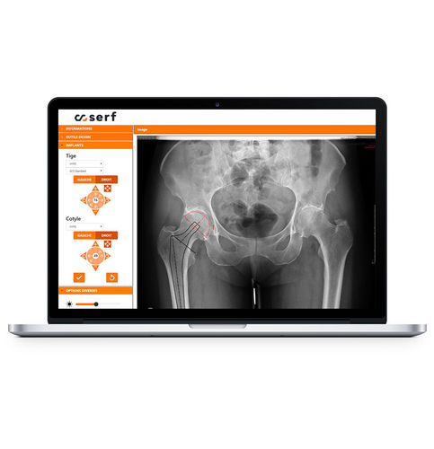 Planungssoftware - SERF - Orthopädie / für Tablet-PC